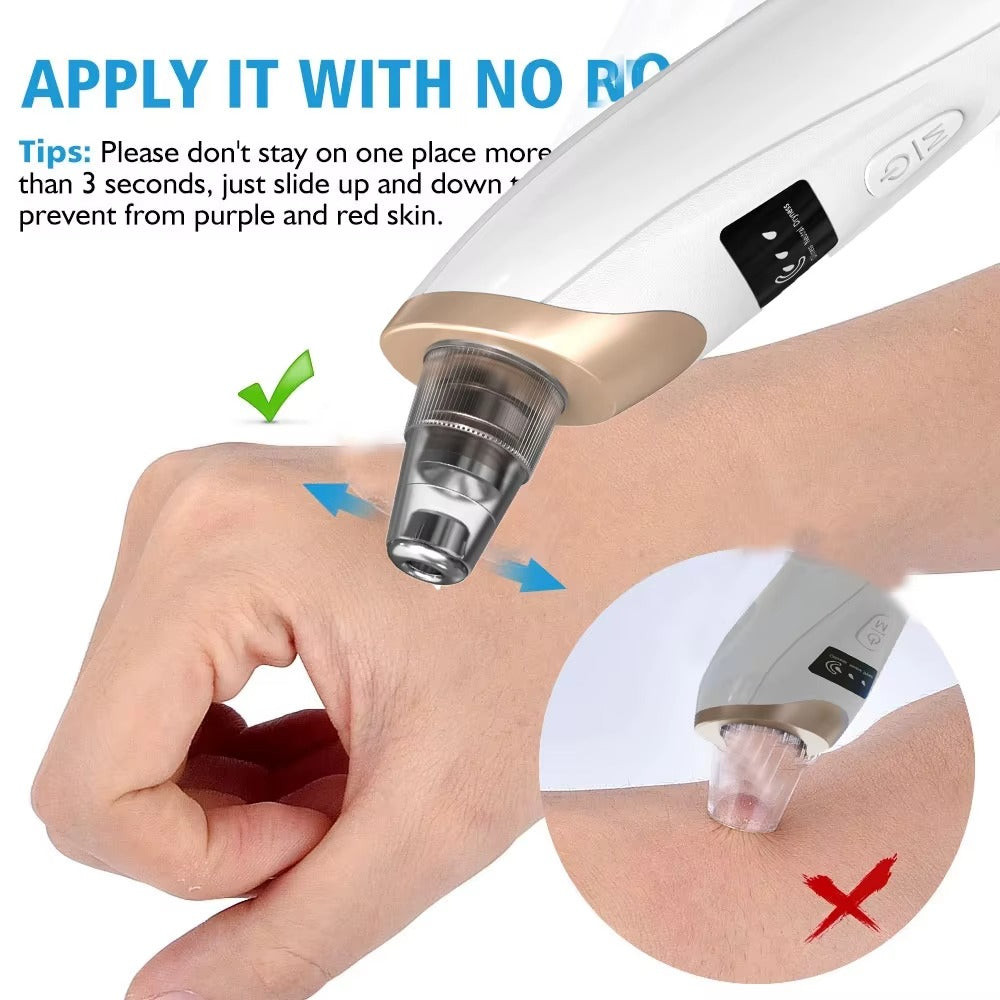 5 In 1 Black Head Remover