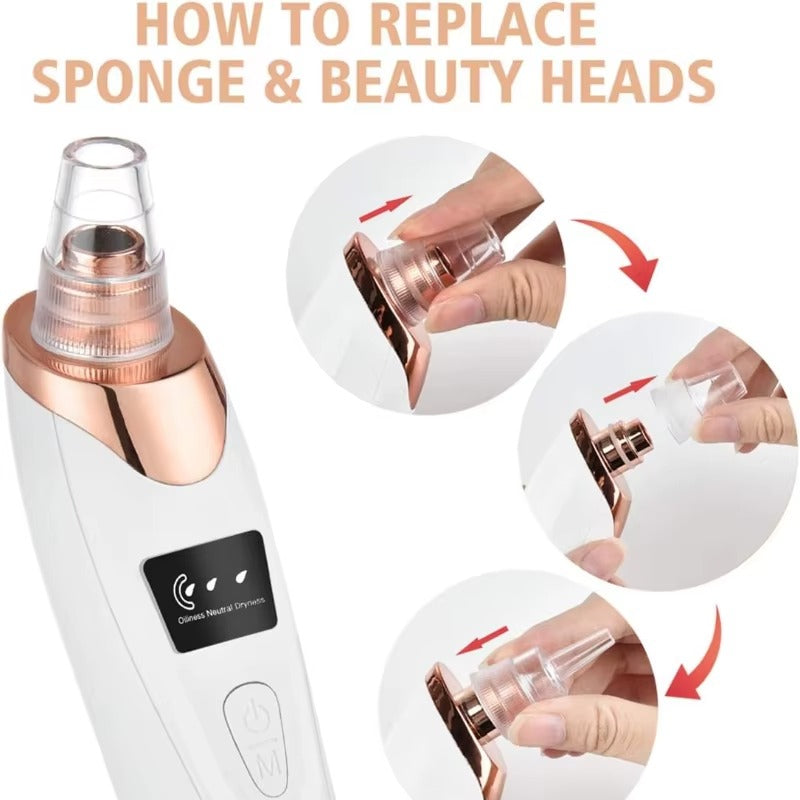 5 In 1 Black Head Remover